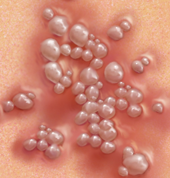 premature-ejaculation-treatment-in-noida