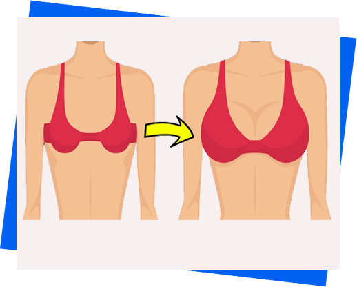 breast-enhancement-in-natural-way