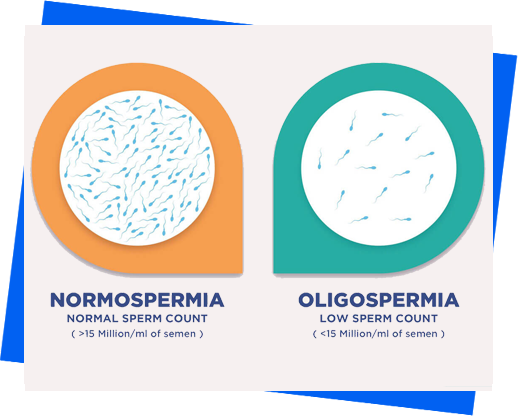 oligoasthenospermia-treatment-in-noida